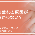 「カルシウムイオンの基礎知識」の第89話タイトル「肌荒れの原因がわからない？」のアイキャッチ画像
